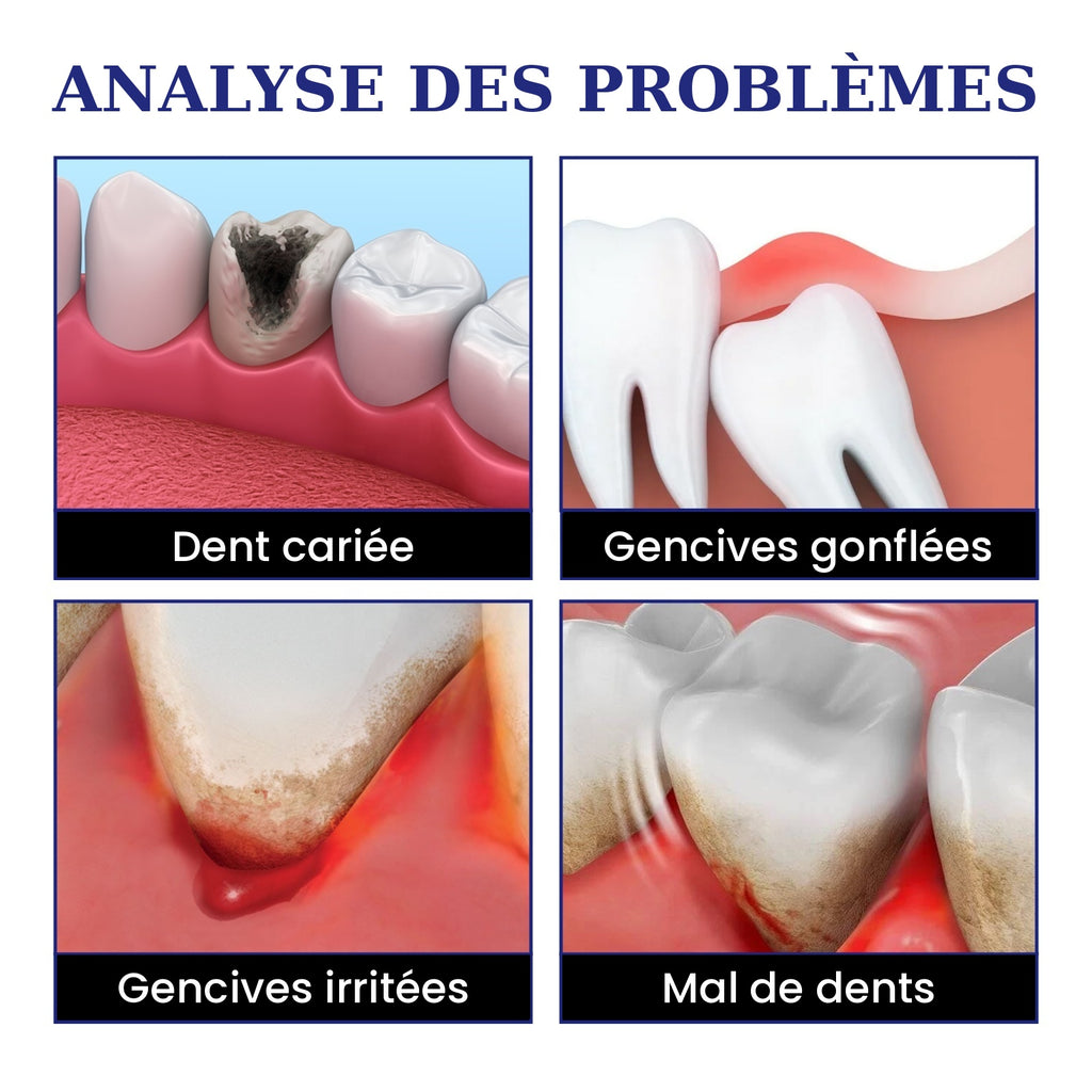 Spray Anti-Mal de Dents – Soulagement Rapide Dents & Gencives
