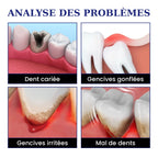Spray Anti-Mal de Dents – Soulagement Rapide Dents & Gencives