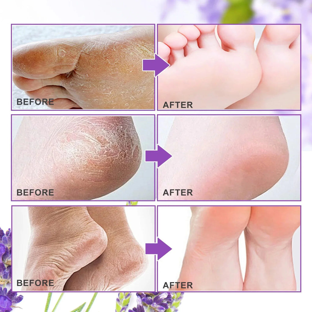 Masque peeling pied