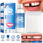 SmileFix™ – Prothèse dentaire moulable