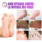 Pommade de confort pour les pieds – Bien-être quotidien