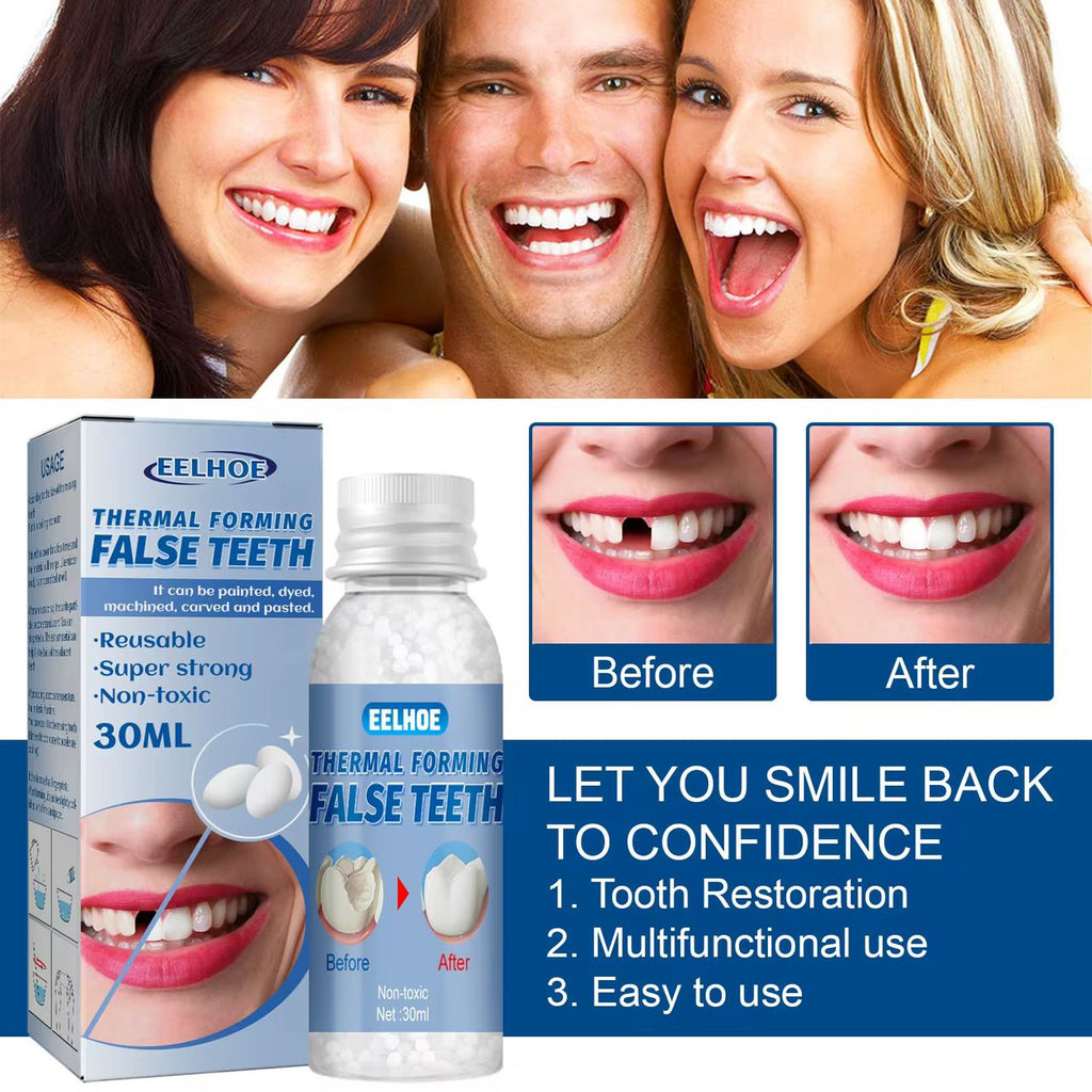 SmileFix™ – Prothèse dentaire moulable