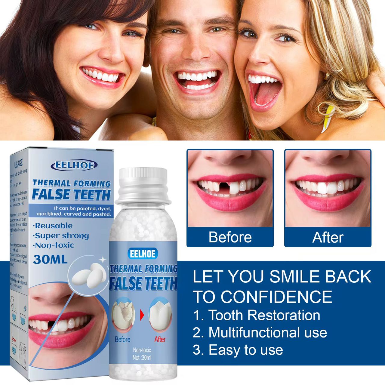 SmileFix™ – Prothèse dentaire moulable